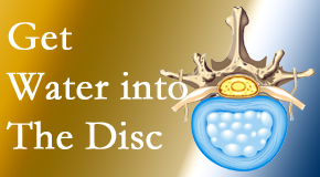 Manchester Chiropractic & Sports Injuries uses spinal manipulation and exercise to boost the diffusion of water into the disc which helps the health of the disc.