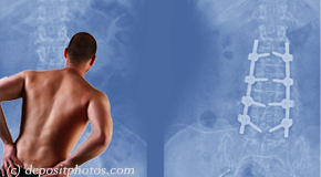 Manchester chiropractic relief for back pain after back surgery