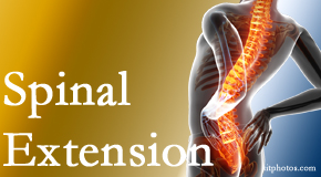 Manchester Chiropractic & Sports Injuries knows the role of extension in spinal motion, its necessity, its benefits and potential harmful effects. 