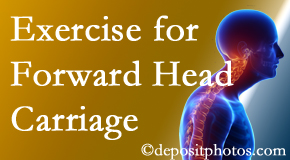 Manchester chiropractic treatment of forward head carriage is two-fold: manipulation and exercise.