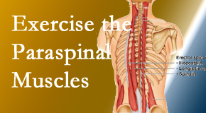 Manchester Chiropractic & Sports Injuries explains the importance of paraspinal muscles and their strength for Manchester back pain relief.