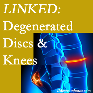 Degenerated discs and degenerated knees are not such strange bedfellows. They are seen to be related. Manchester patients with a loss of disc height due to disc degeneration often also have knee pain related to degeneration.  