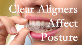 Clear aligners influence posture which Manchester chiropractic helps.