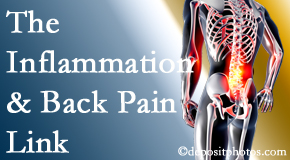 Manchester Chiropractic & Sports Injuries tackles the inflammatory process that accompanies back pain as well as the pain itself.