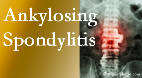 Ankylosing spondylitis is gently cared for by your Manchester chiropractor.