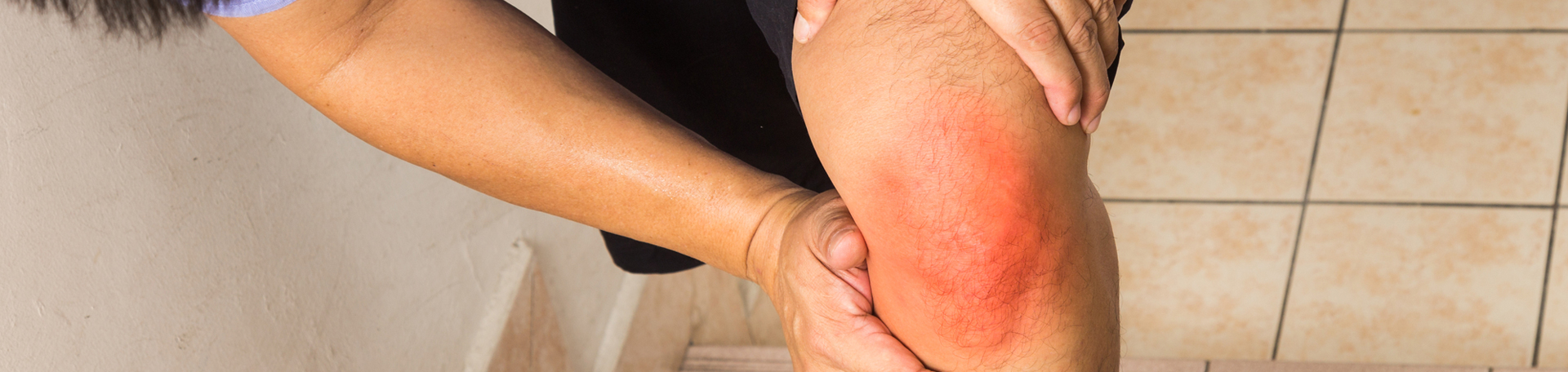 Manchester knee pain, osteoarthritis