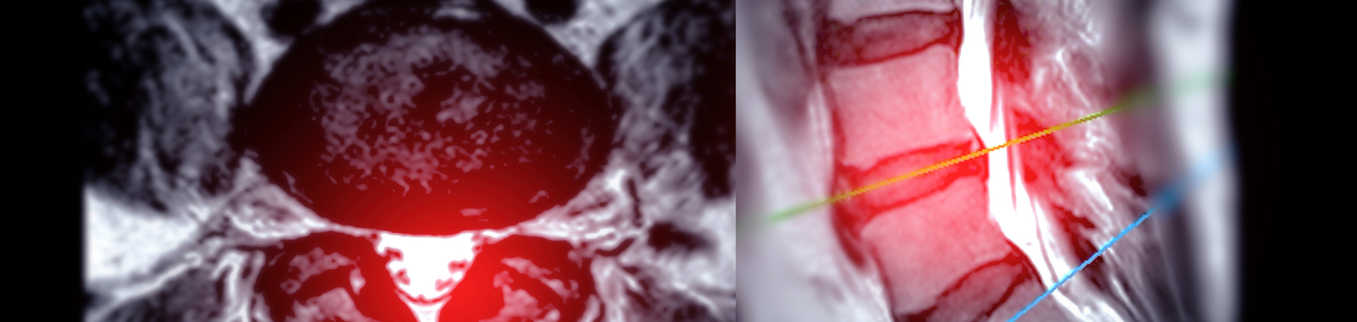 Manchester back pain imaging and exercise