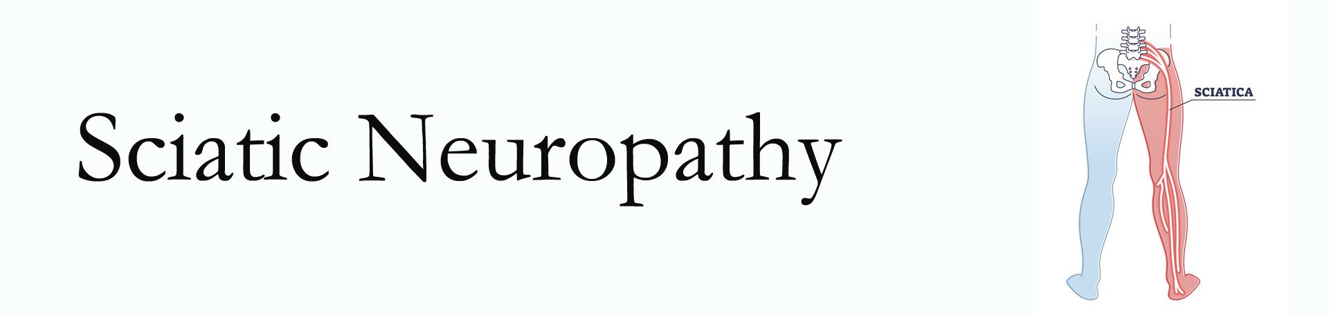 Manchester neuropathy pain (sciatica)