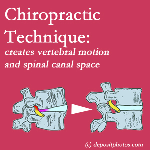 image of a Manchester spinal stenotic canal