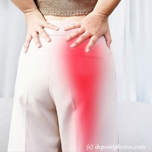 image of Manchester leg pain, sciatica, lumbar radiculopathy