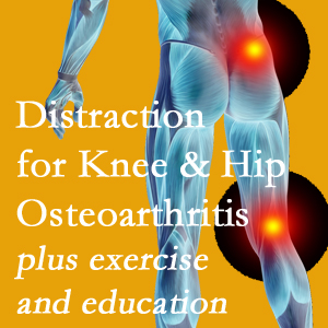 A chiropractic treatment plan for Manchester knee pain and hip pain caused by osteoarthritis: education, exercise, distraction.
