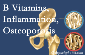 Manchester chiropractic care of osteoporosis usually comes with nutritional tips like b vitamins for inflammation reduction and for prevention.
