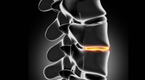 Manchester chiropractic nutrition with vitamin D and quercitrin