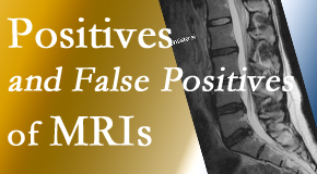 Manchester Chiropractic & Sports Injuries carefully chooses when and if MRI images are needed to guide the Manchester chiropractic treatment plan. 